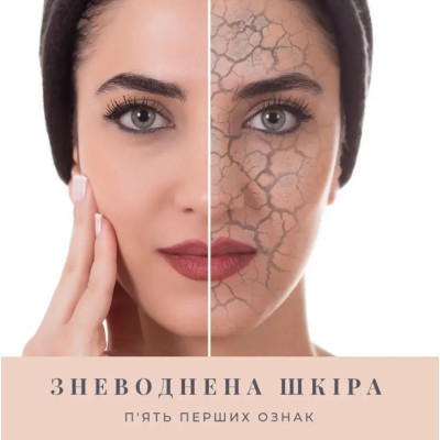 Суха чи зневоднена? ❤ StoyanA prof